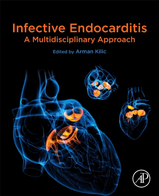 Infective Endocarditis: A Multidisciplinary Approach