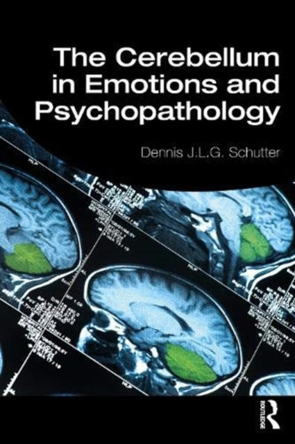 Cerebellum in Emotions and Psychopathology