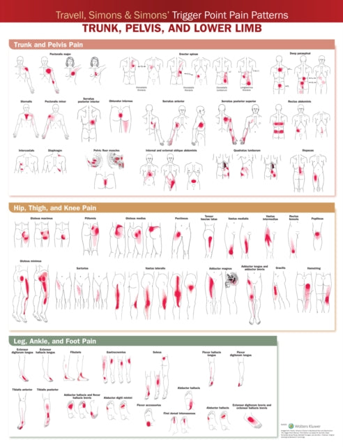 Travell, Simons & Simons' Trigger Point Pain Patterns Wall Chart: Trunk, Pelvis, and Lower Limb