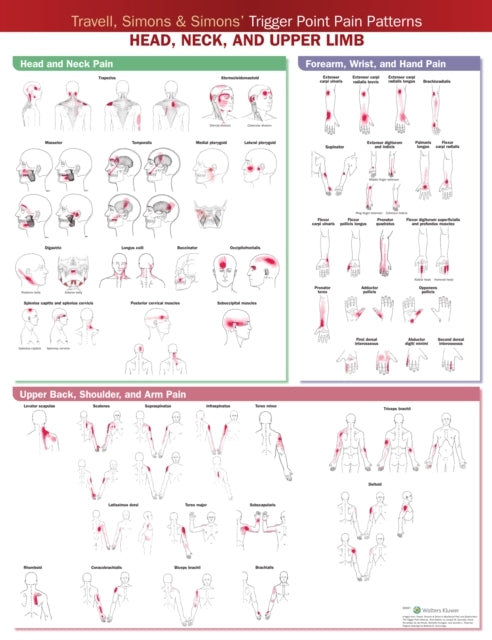 Travell, Simons & Simons' Trigger Point Pain Patterns Wall Chart: Head, Neck, and Upper Limb