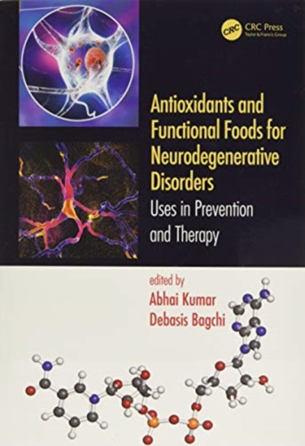 Antioxidants and Functional Foods for Neurodegenerative Disorders: Uses in Prevention and Therapy