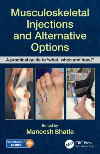 Musculoskeletal Injections and Alternative Options: A practical guide ...
