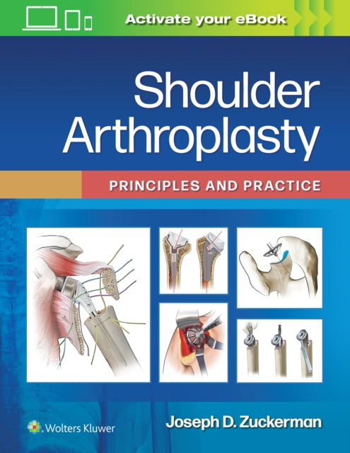 Shoulder Arthroplasty: Principles and Practice