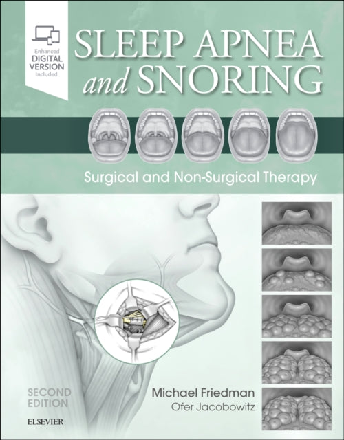 Sleep Apnea and Snoring: Surgical and Non-Surgical Therapy