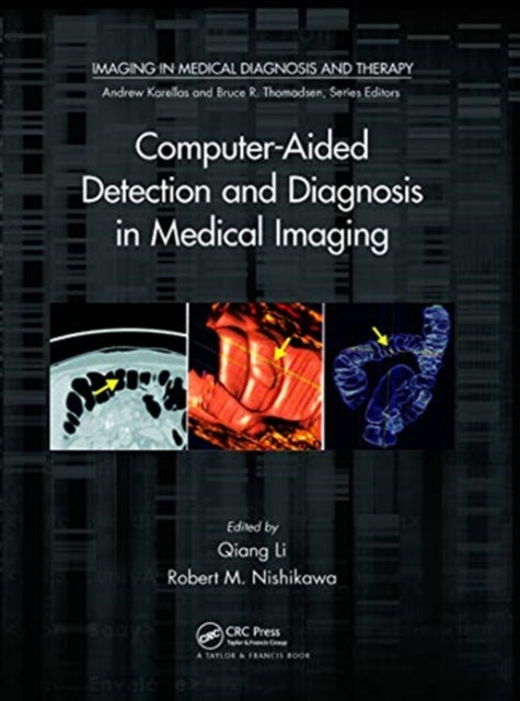 Computer-Aided Detection and Diagnosis in Medical Imaging