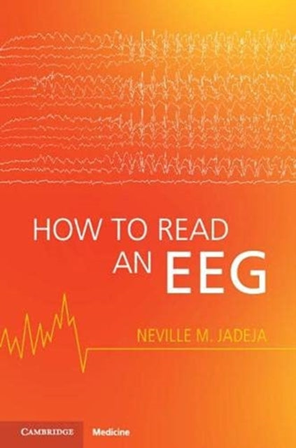 How to Read an EEG