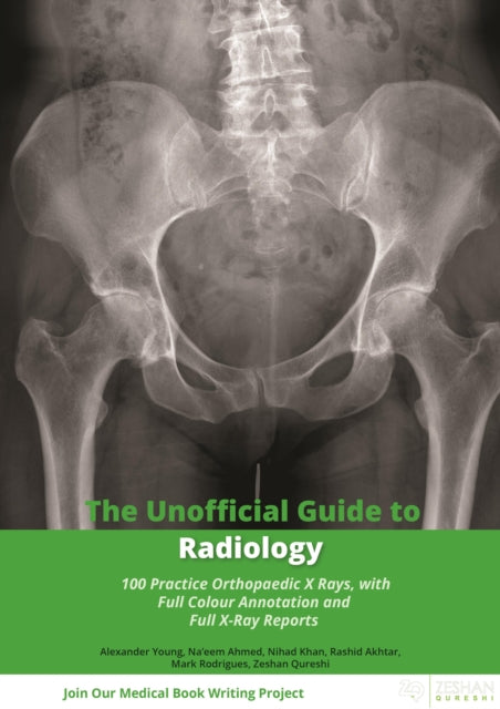 Unofficial Guide to Radiology: 100 Practice Orthopaedic X Rays with Full Colour Annotations and Full X Ray Reports