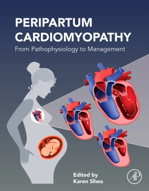 Peripartum Cardiomyopathy: From Pathophysiology to Management
