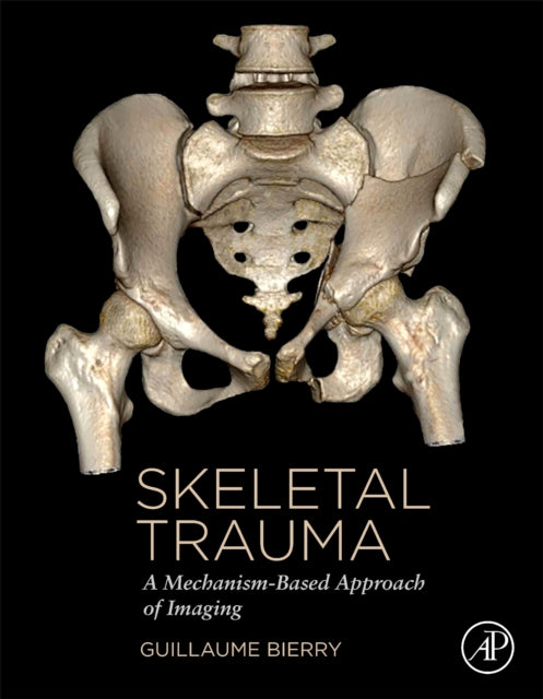 Skeletal Trauma: A Mechanism-Based Approach of Imaging