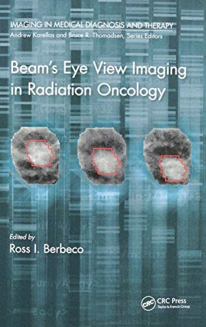 Beam's Eye View Imaging in Radiation Oncology