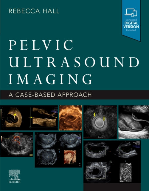 Pelvic Ultrasound Imaging: A Cased-Based Approach