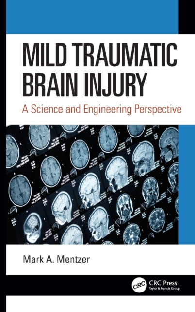 Mild Traumatic Brain Injury: A Science and Engineering Perspective