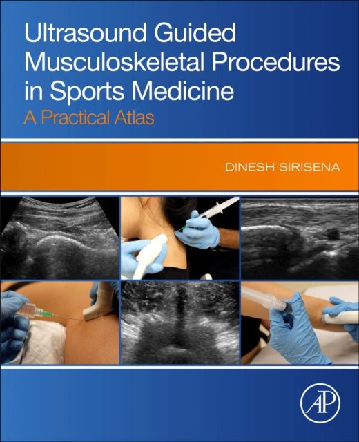 Ultrasound Guided Musculoskeletal Procedures in Sports Medicine: A Practical Atlas