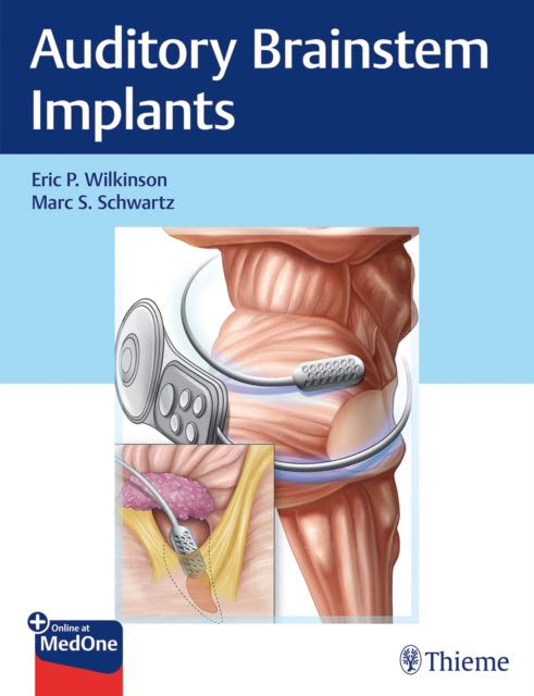 Auditory Brainstem Implants