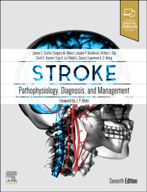 Stroke: Pathophysiology, Diagnosis, and Management