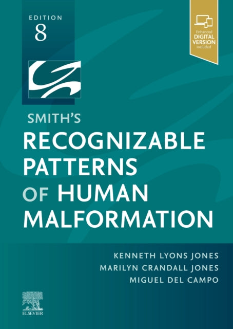 Smith'S Recognizable Patterns of Human Malformation