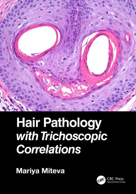 Hair Pathology with Trichoscopic Correlations