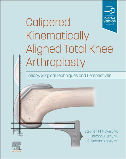 Calipered Kinematically aligned Total Knee Arthroplasty: Theory, Surgical Techniques and Perspectives