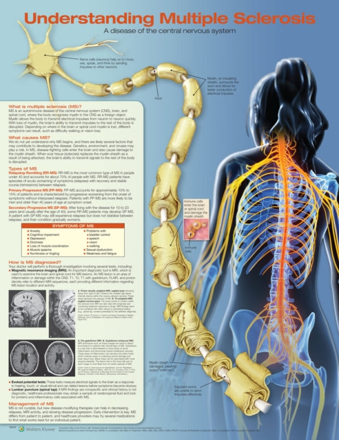 Understanding Multiple Sclerosis