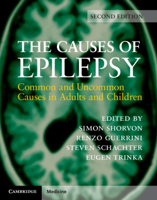 Causes of Epilepsy: Common and Uncommon Causes in Adults and Children