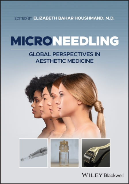 Microneedling: Global Perspectives in Aesthetic Medicine