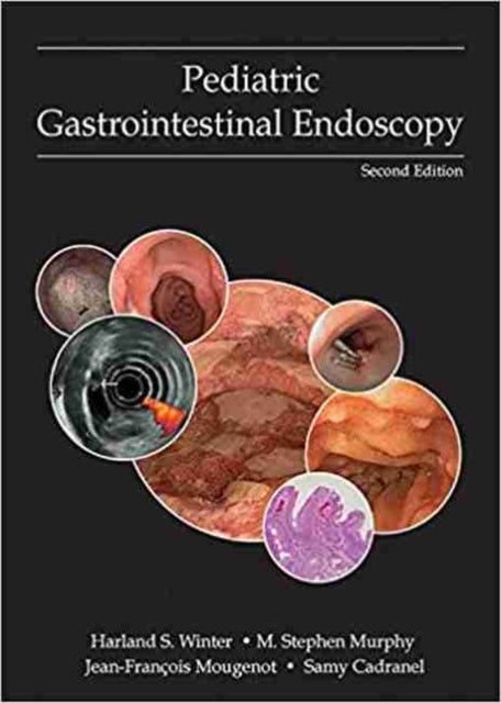 Pediatric Gastrointestinal Endoscopy