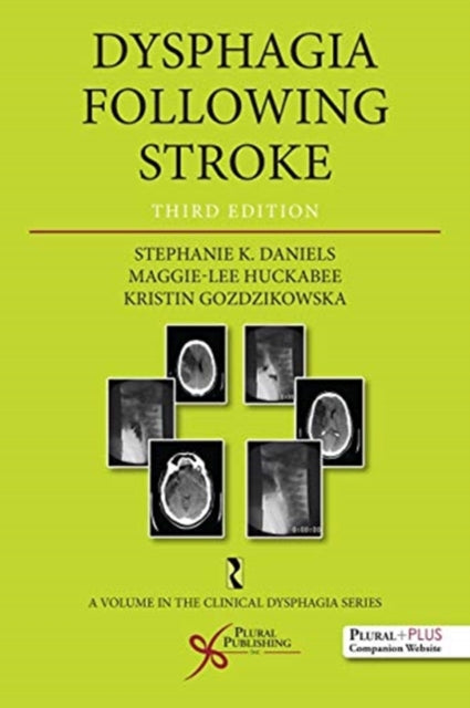 Dysphagia Following Stroke