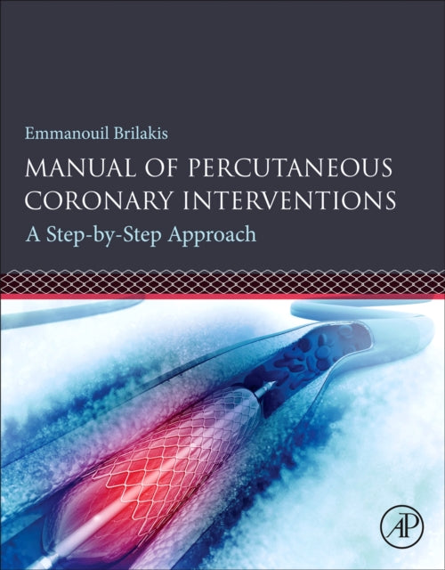 Manual of Percutaneous Coronary Interventions: A Step-by-Step Approach