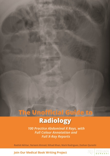 Unofficial Guide to Radiology: 100 Practice Abdominal X Rays with Full Colour Annotations and Full X Ray Reports