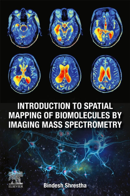 Introduction to Spatial Mapping of Biomolecules by Imaging Mass Spectrometry